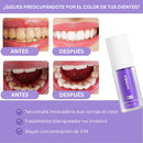 Blanqueador Dental V34™ - TRENDFINDER® (2025) ⭐⭐⭐⭐⭐